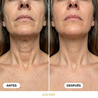 Masajeador Zalino Efecto Anti-Edad Reafirma Tu Cuello en una Semana (Copia)