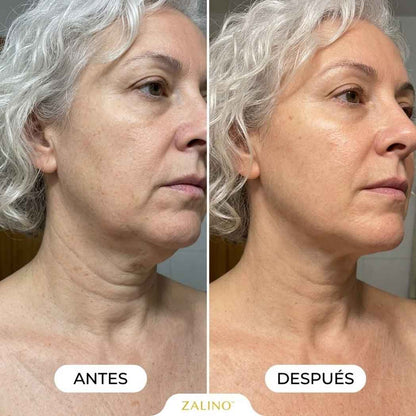 Masajeador Zalino Efecto Anti-Edad Reafirma Tu Cuello en una Semana (Copia)